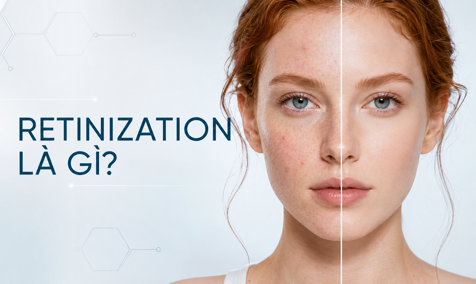 Retinization Là Gì? Phân Biệt Da Thích Nghi Và Kích Ứng