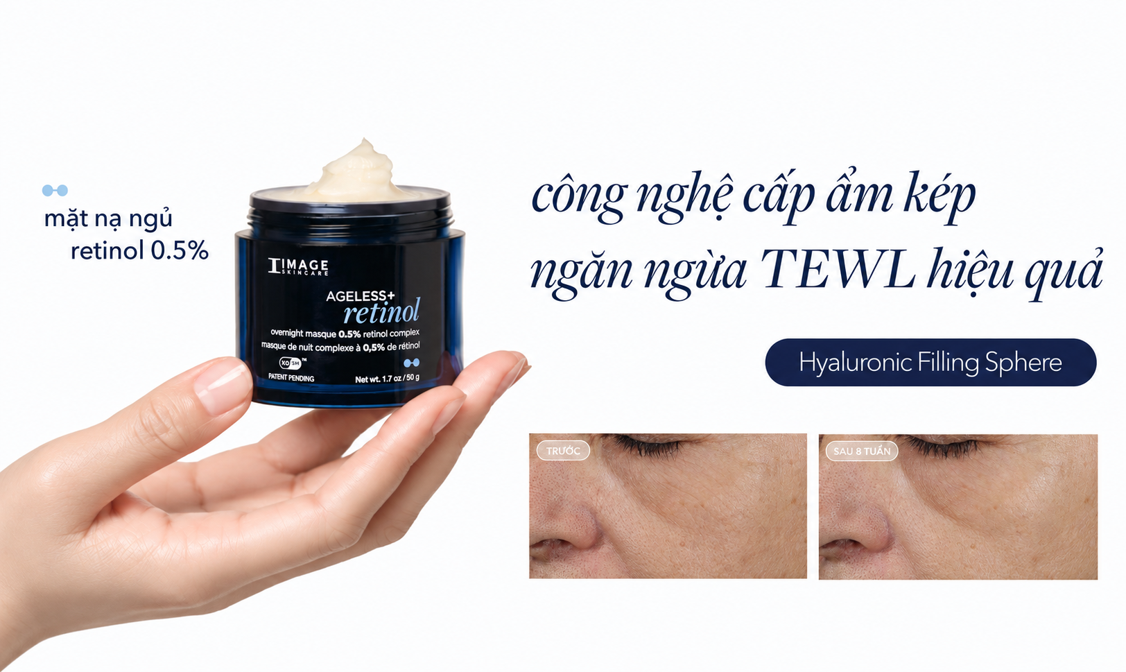 Retinol Cho Nếp Nhăn Do Mất Nước: Cách Chăm Da Khoa Học Hơn