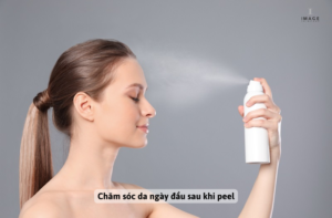 Ngày đầu sau peel 