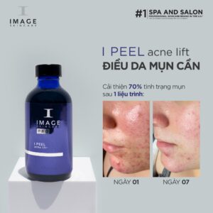 Peel image trị mụn