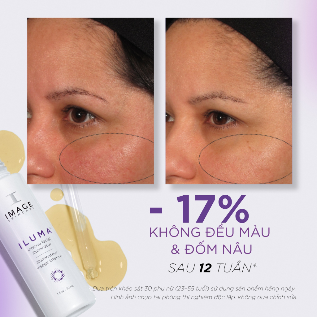 Khảo sát khi dùng Illuminator
