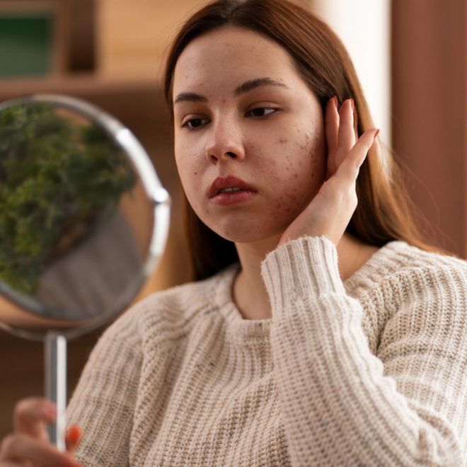 Kem chống nắng cho tuổi dậy thì