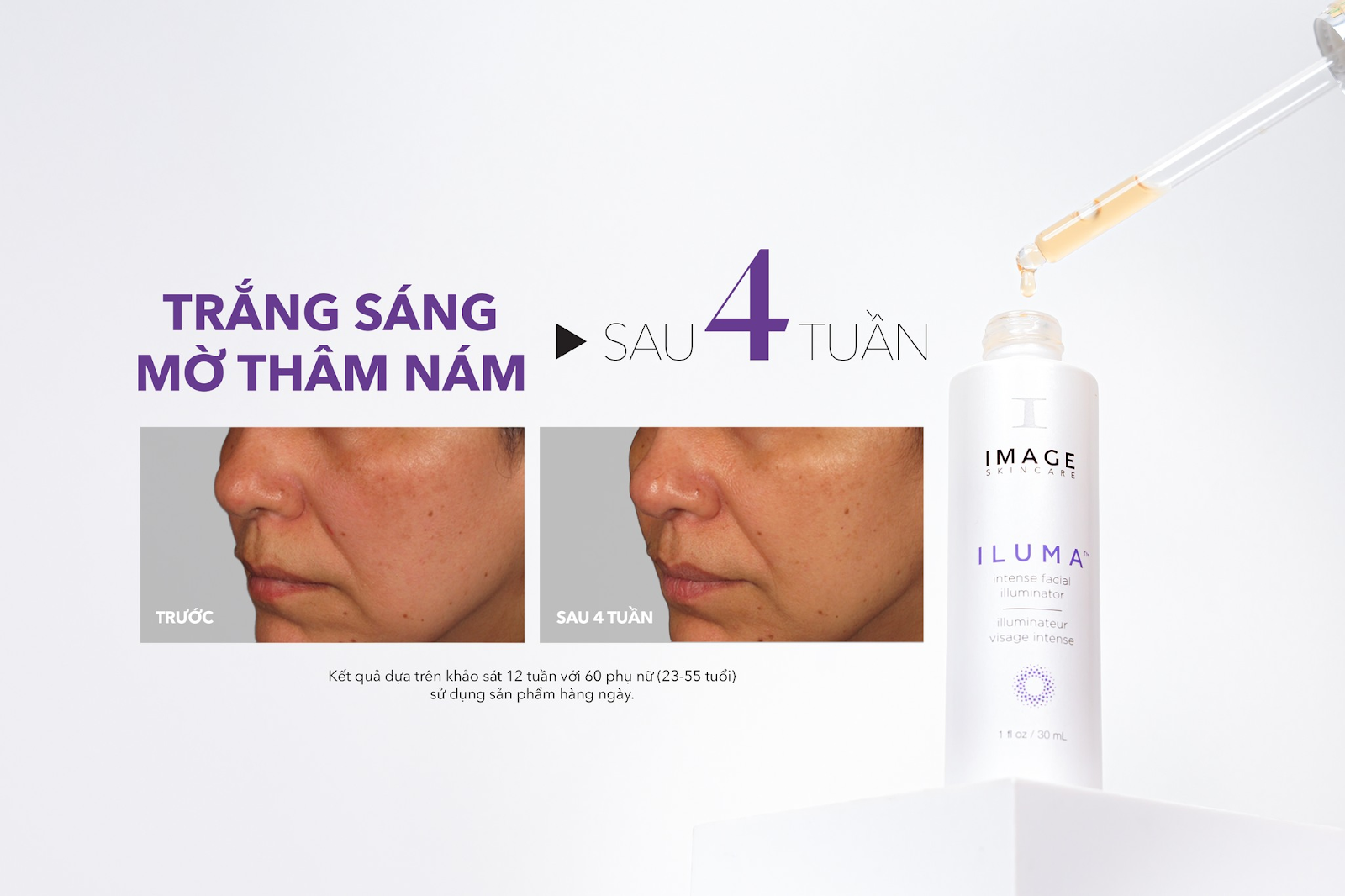 Serum trị nám hiệu quả